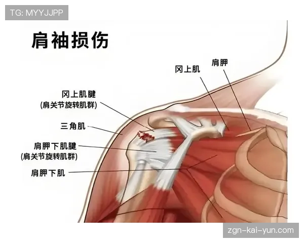 [战队名]队医团队访谈：职业选手的视力保护和肌肉损伤预防是第一优先级